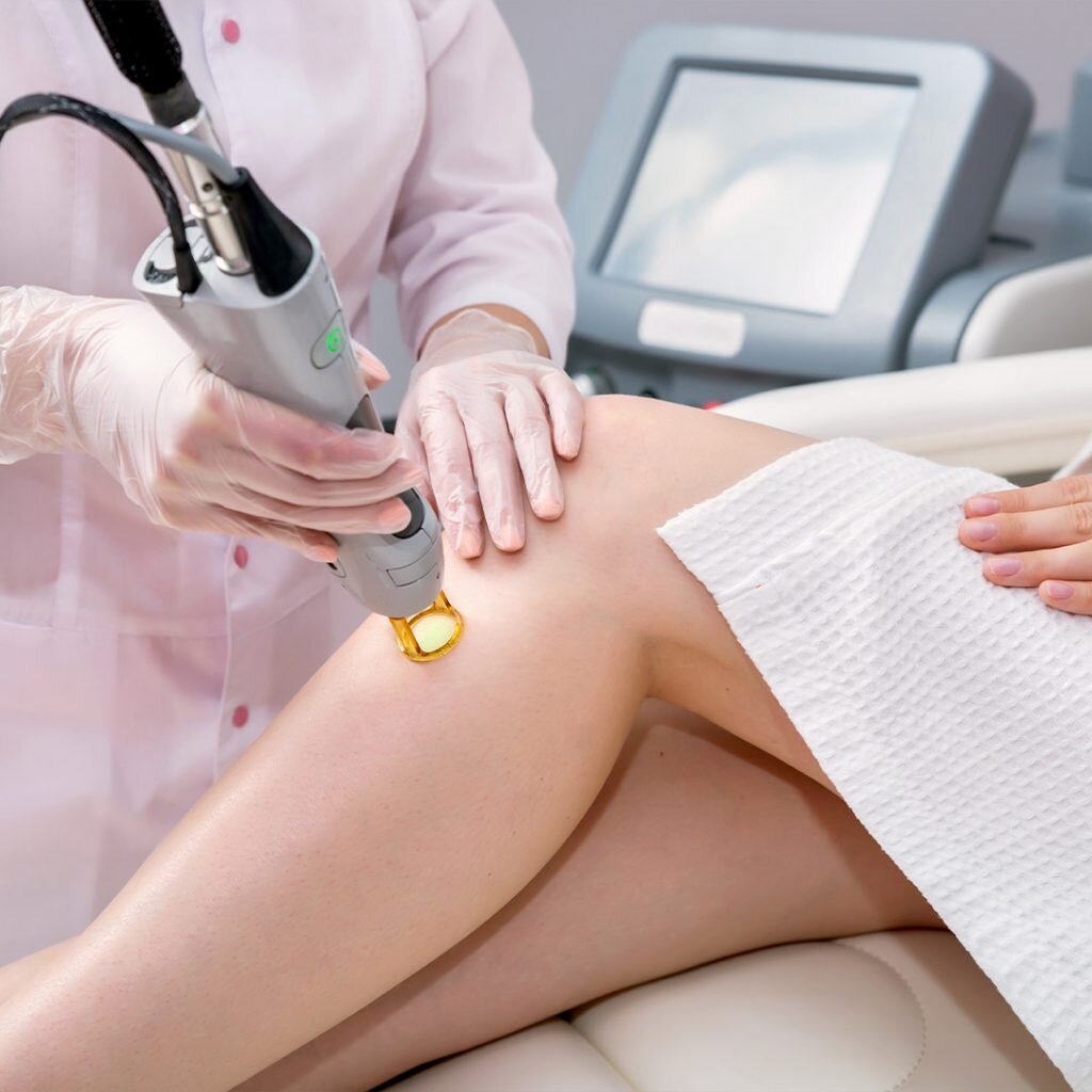 musta lazer epilasyonu nerede yapilir